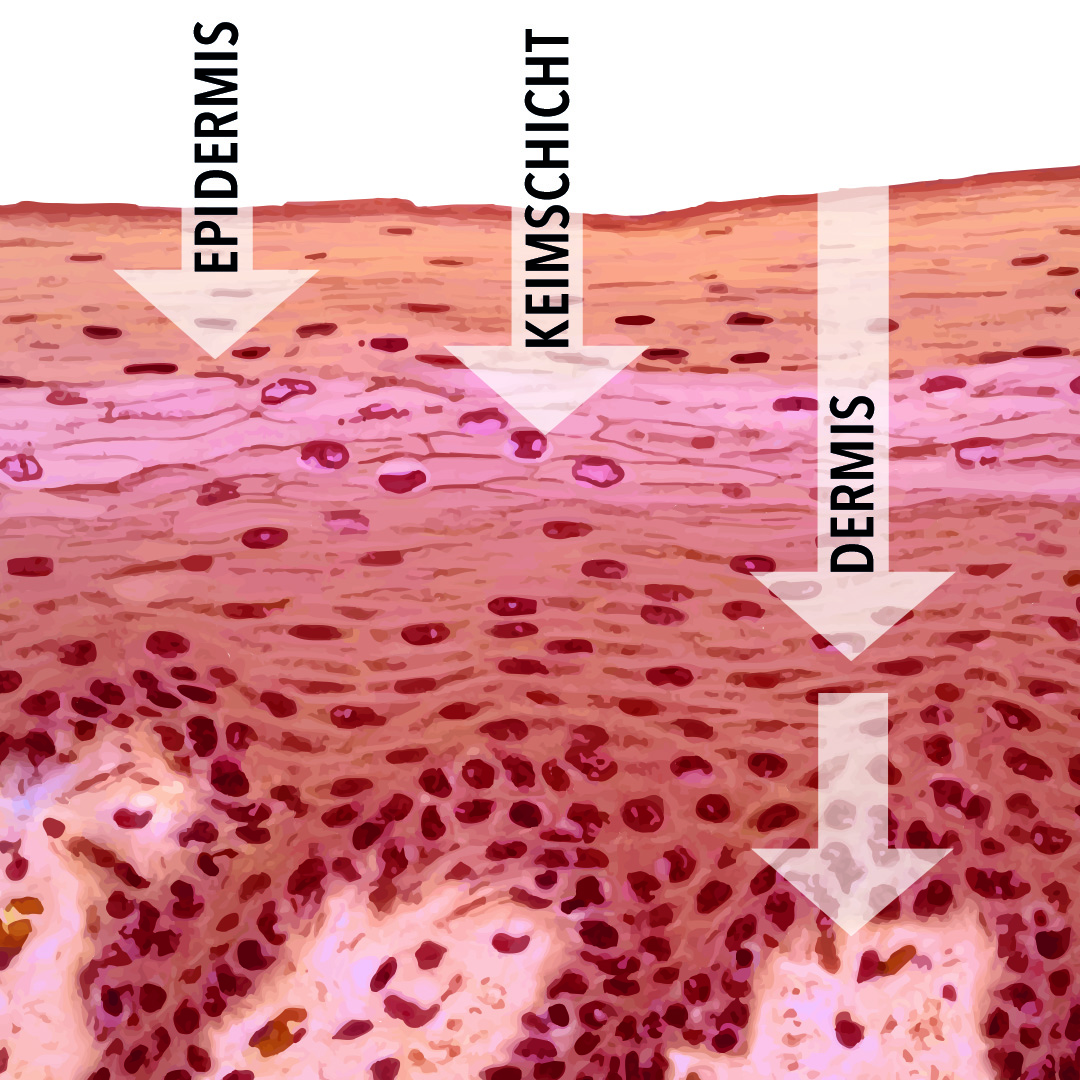 DMS-Basis von dermaceutical