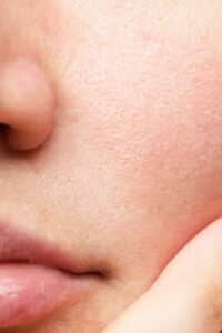 Aufbau der Epidermis