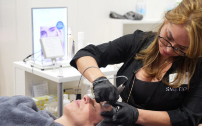 Das leistet eine Needling Behandlung für deine Haut